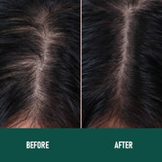 Anti-Hair Loss Mousse CH004 Minoxidil Anti-Hair Loss Mousse